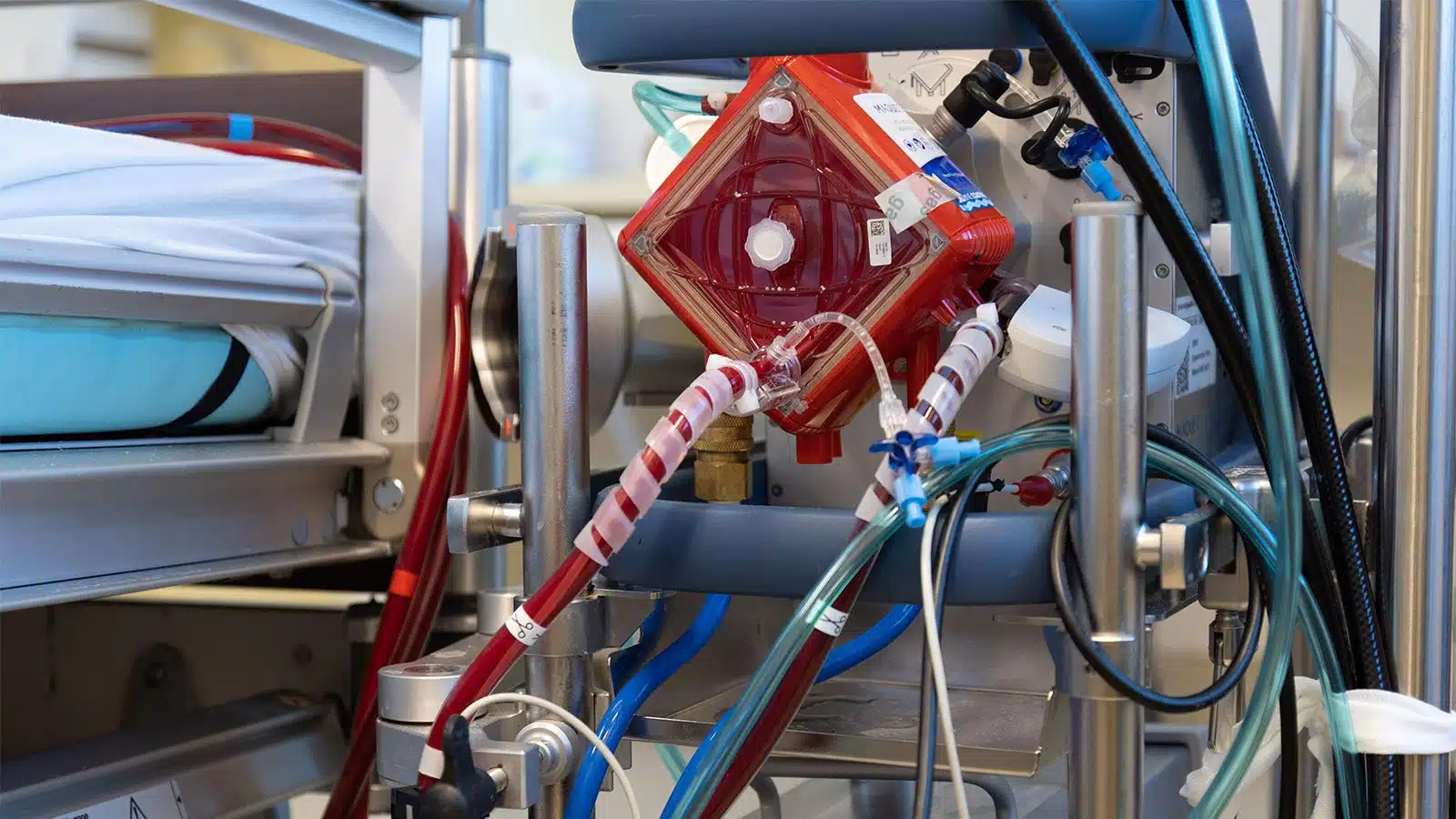 foto ravvicinata dell'ECMO in una stanza di ospedale