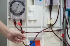 mano di un operatore che sistema la macchina per la dialisi