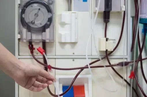 mano di un operatore che sistema la macchina per la dialisi