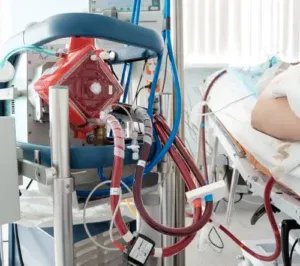 foto dell'ECMO attaccata a un paziente sul lettino dell'ospedale