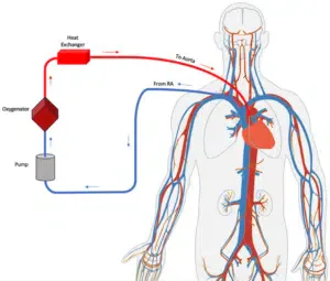 disegno esplicativo del funzionamento dell'ECMO